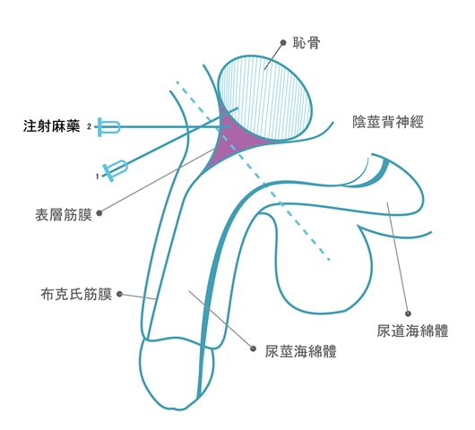 新聞稿描圖